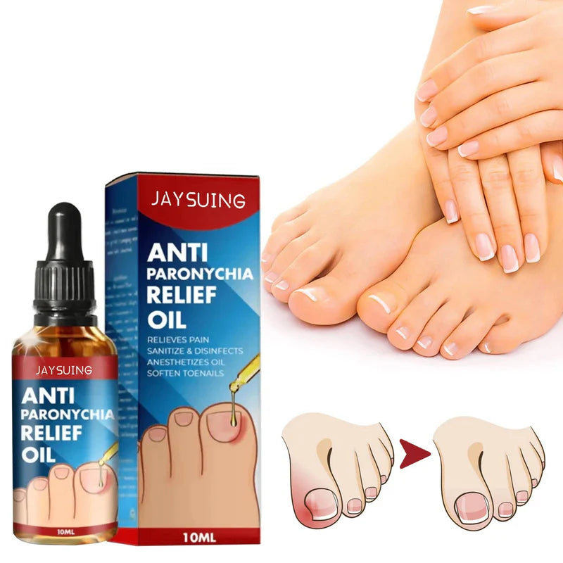 Ulei Antifungic