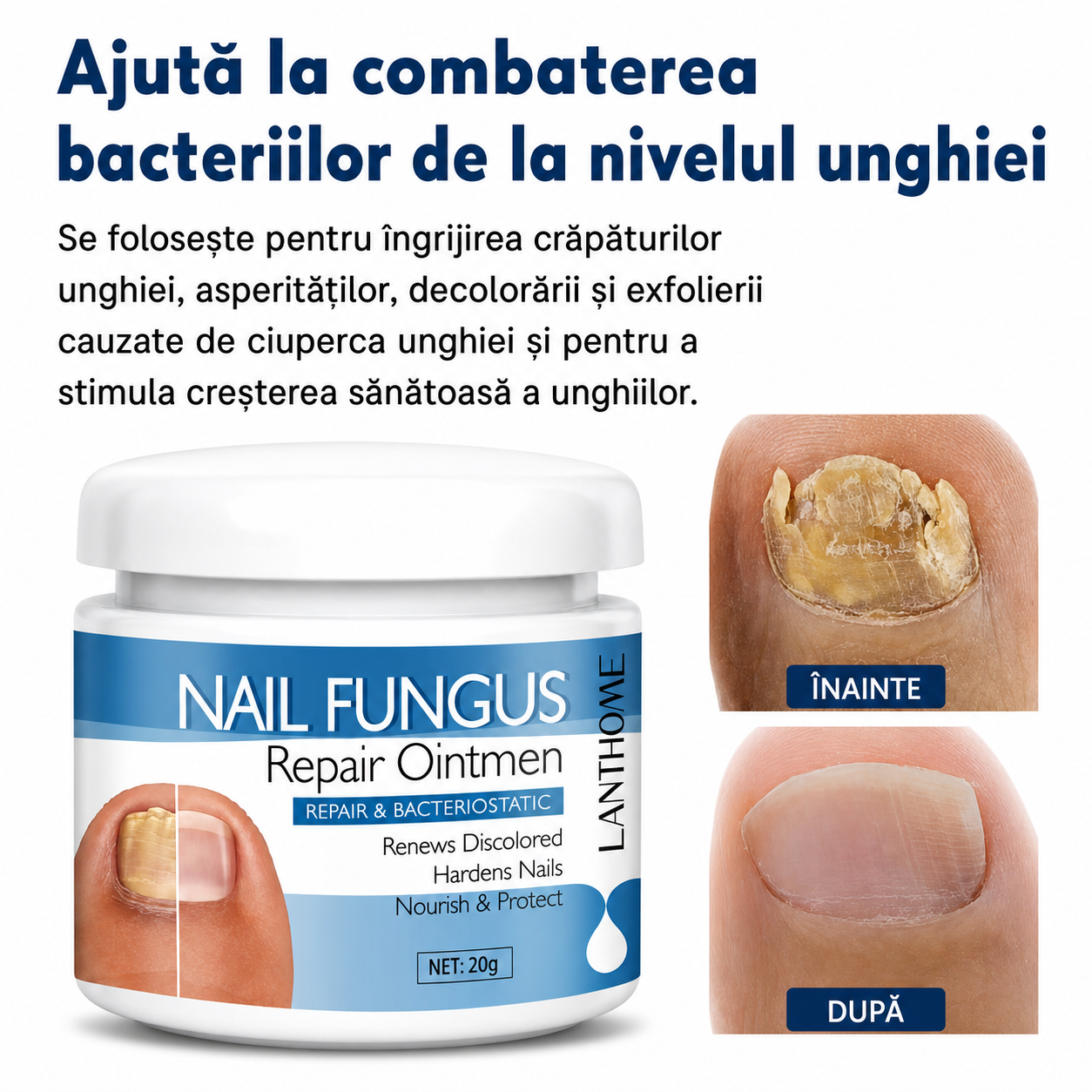 Cremă Antifungică
